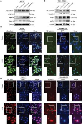 IL-1β Promotes Vasculogenic Mimicry of Breast Cancer Cells Through p38/MAPK and PI3K/Akt Signaling Pathways